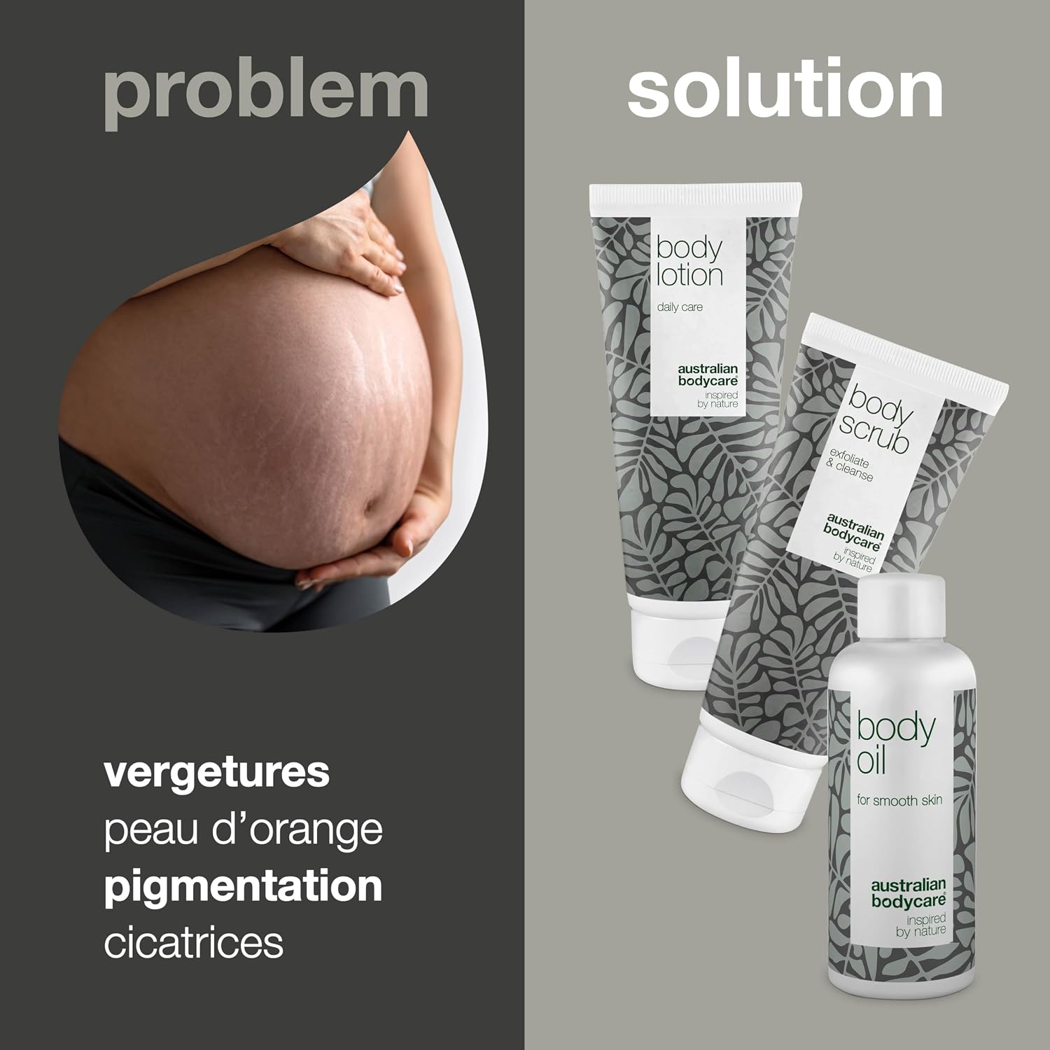 Kit de 3 produit à l’huile de tea tree pour réduire les vergetures et les cicatrices se compose d’un gommage corporel (200 ml), d’une huile corporelle (150 ml) & d’une lotion corporelle (200 ml)